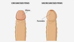 Mens health