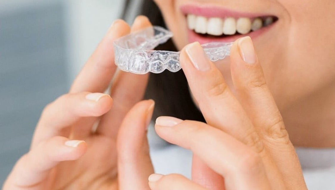 Things You Need to Know Before Getting Invisalign Aligners