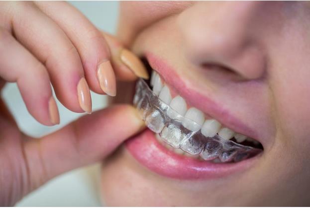 What Happens After Your Invisalign Treatment Ends?
